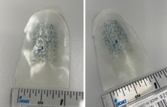 Microneedle pads with rulers for scale