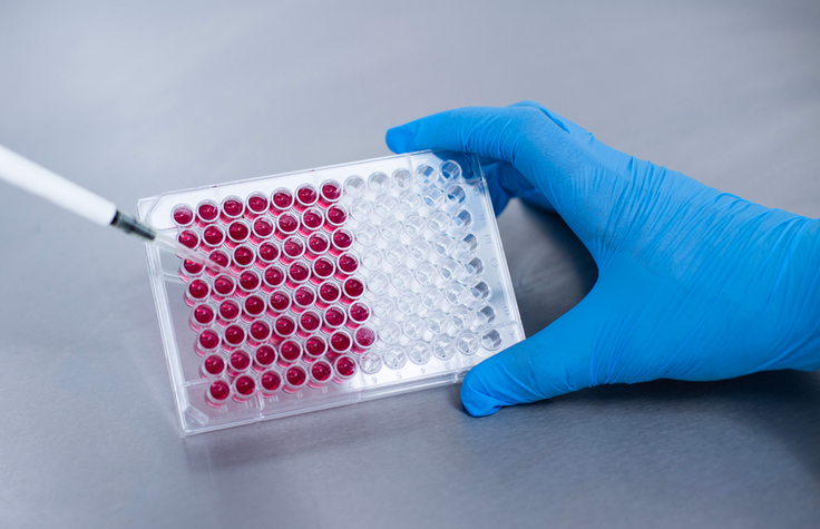 A medical expert's hand holding a vile of blood samples